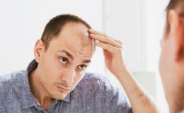 Erkeklerin en büyük kâbuslarından… Saç dökülmesinin 3 nedeni